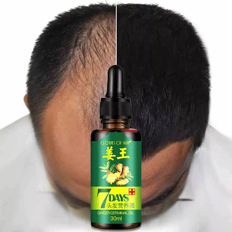 Ginger King Hair Nutrition Serum – Strengthening & Revitalizing Formula